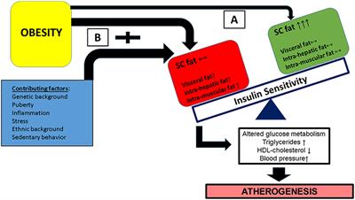 Obesity as the Main Risk Factor for Metabolic Syndrome in Children